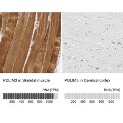 PDLIM3 Antibody, Novus Biologicals:Antibodies:Primary Antibodies